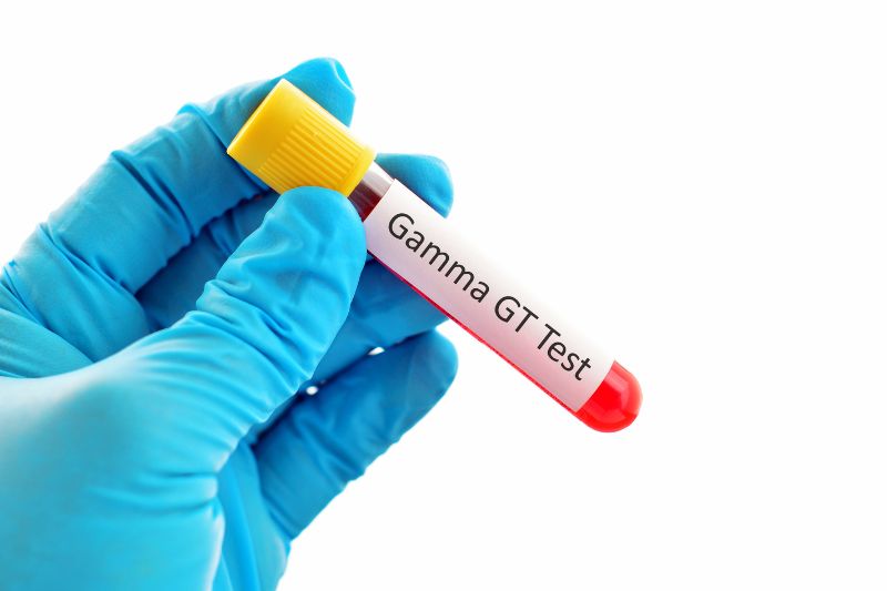 All You need to know about Gamma-Glutamyl Transferase (GGT) Test