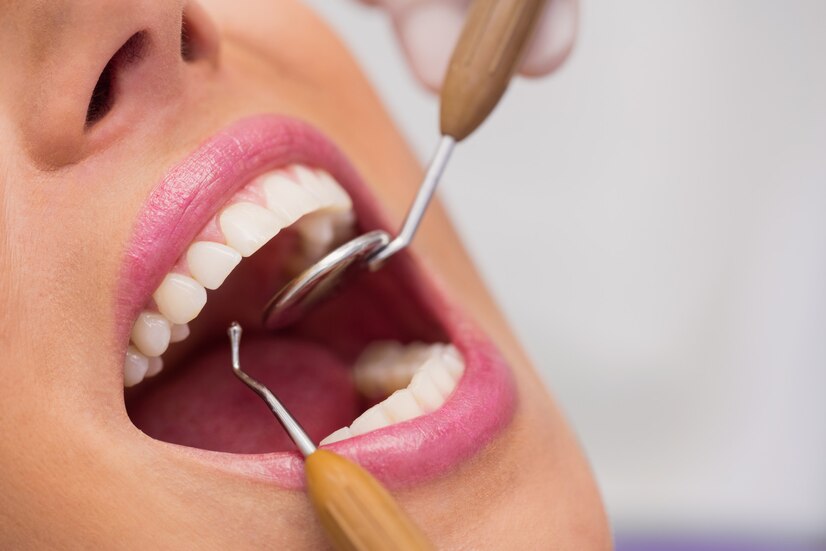 Enhancing Smiles with Cosmetic Dentistry in Chattanooga