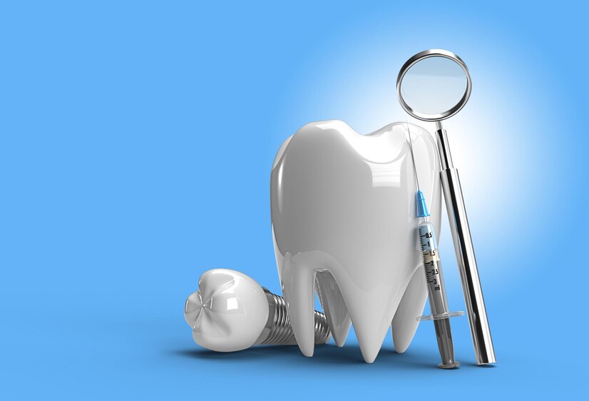 Understanding the Cost of Dental Implants in Pearl, MS