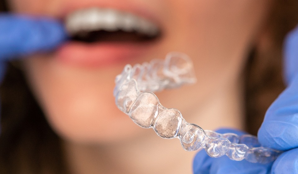 Why Invisalign is the Top Choice for Orthodontics in White Oak, TX