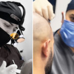 Why Choose Dr. Resul Yaman Among Turkish Clinics in 2025?