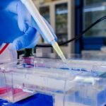 Why Does SDS PAGE Electrophoresis Remain Essential in the Age of AI?