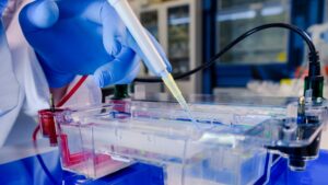 How to Choose Wash Buffers for Protein G Column Antibody Purification